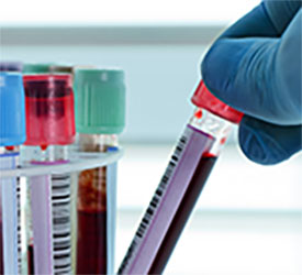 Phlebotomy