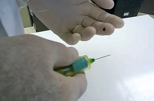 Accidental Needle Stick