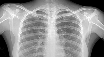 Radiology