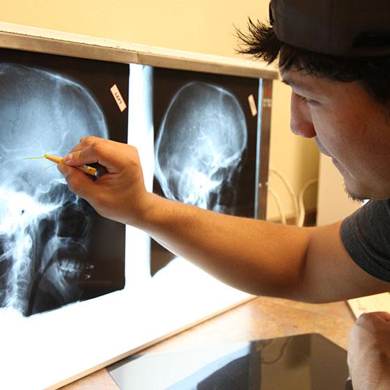 Radiography A