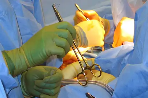 Surgery in Progress with Instruments